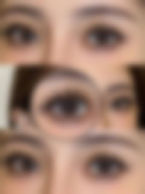 兰州悦美丽整形医院口碑好不好？附真实患者口碑评价