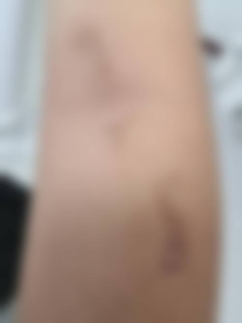 韩国ELLIUM（爱丽美）女性医院项目特色