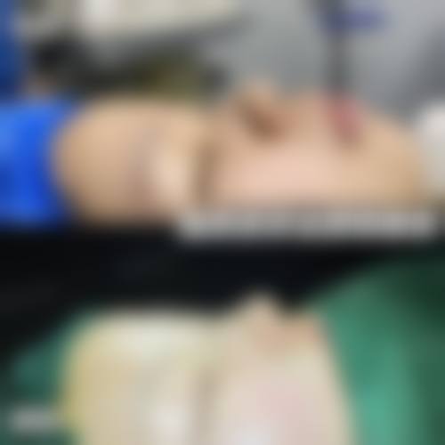 南通英莎医疗美容门诊部李辉综合口碑评价