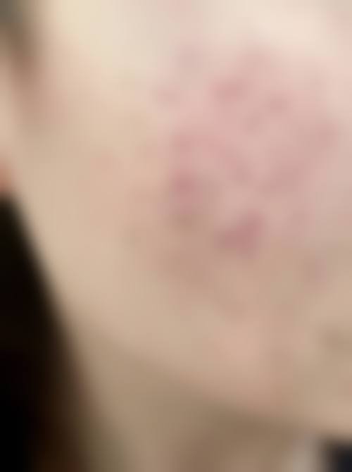 赵欢医生简介做手术价格