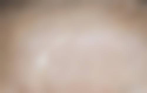 揭阳华美医疗整形美容医院口碑评价