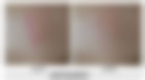 李云霞医生简介做手术价格