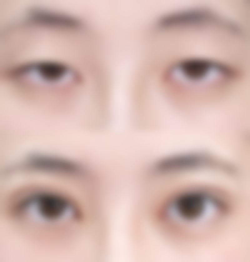 李云霞医生简介怎么挂号