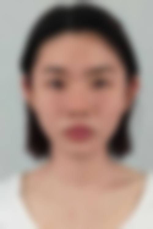 深圳科美丽格整形医疗美容门诊部顾客实例