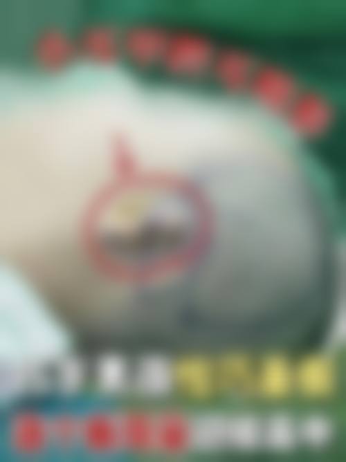 开封美缘整形美容医院项目特色