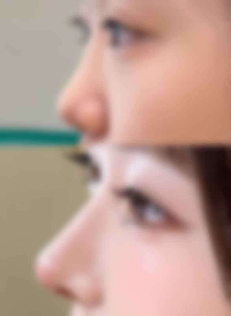 濮阳秀美医疗美容诊所可靠吗
