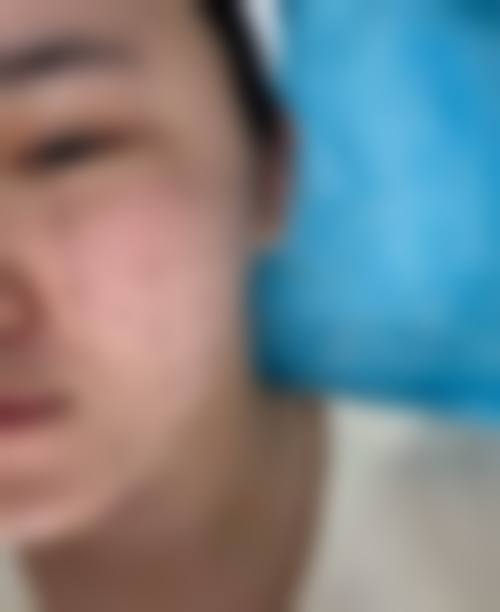 七、厦门雪梨白整形医院怎么样：价格表