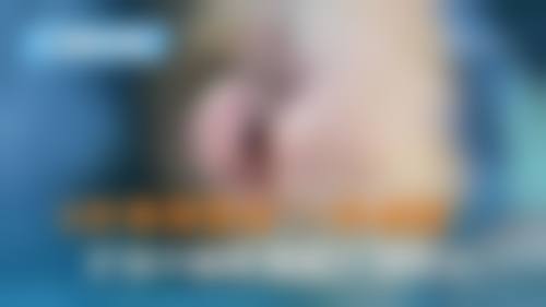 无锡丽都整形美容医院·刘丽娜医生真人实例与患者口碑