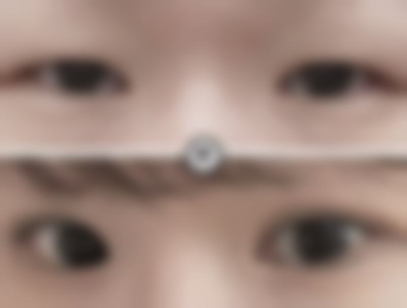 李惠媛医生简介做手术价格