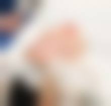 昆明医 科 大学第二附属医院肖鸿医生做手术价格