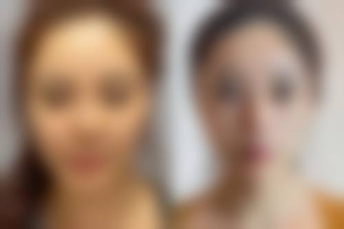 达州魔丽美颜整形医院项目特色