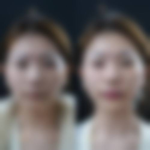 韩国伊美芝整形医院价格表