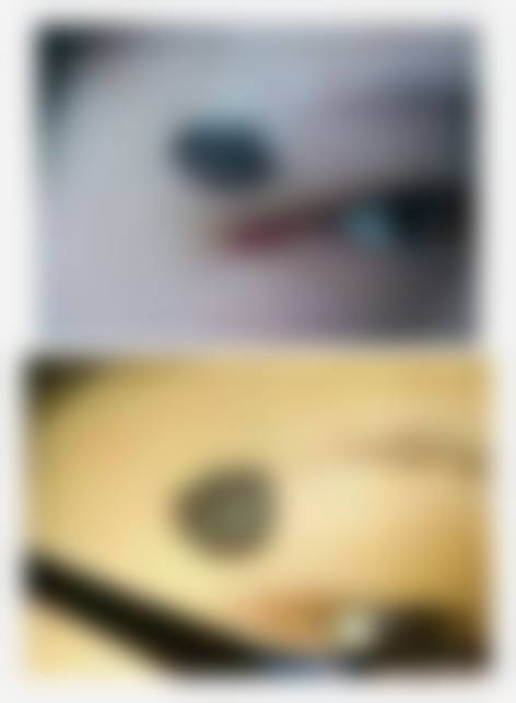童渝眉医生简介项目优势体现