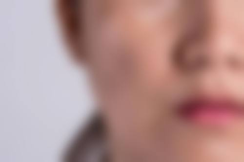 郑州刘少顺医疗美容诊所更擅长什么手术