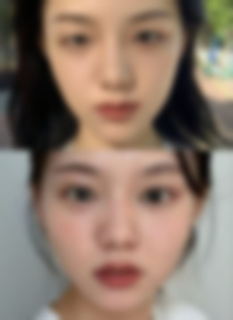 来宾颜白玉医疗美容诊所怎么样，更擅长什么手术