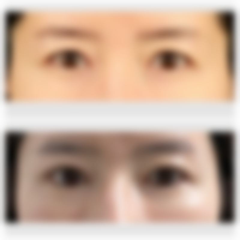 许丽霞医生简介做手术价格