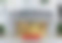重庆联合丽格第五医疗美容医院王阳案例效果惊艳，乔雅登丰颜XC玻尿酸+飞顿钛提升套餐仅需5935元