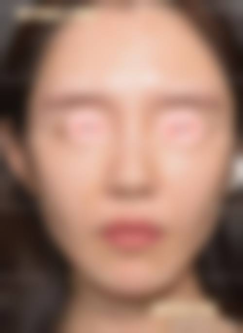 成都美卿医疗美容医院项目特色