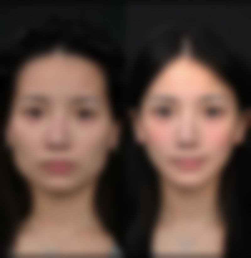 邯郸韩雅医疗美容整形门诊部的特色项目