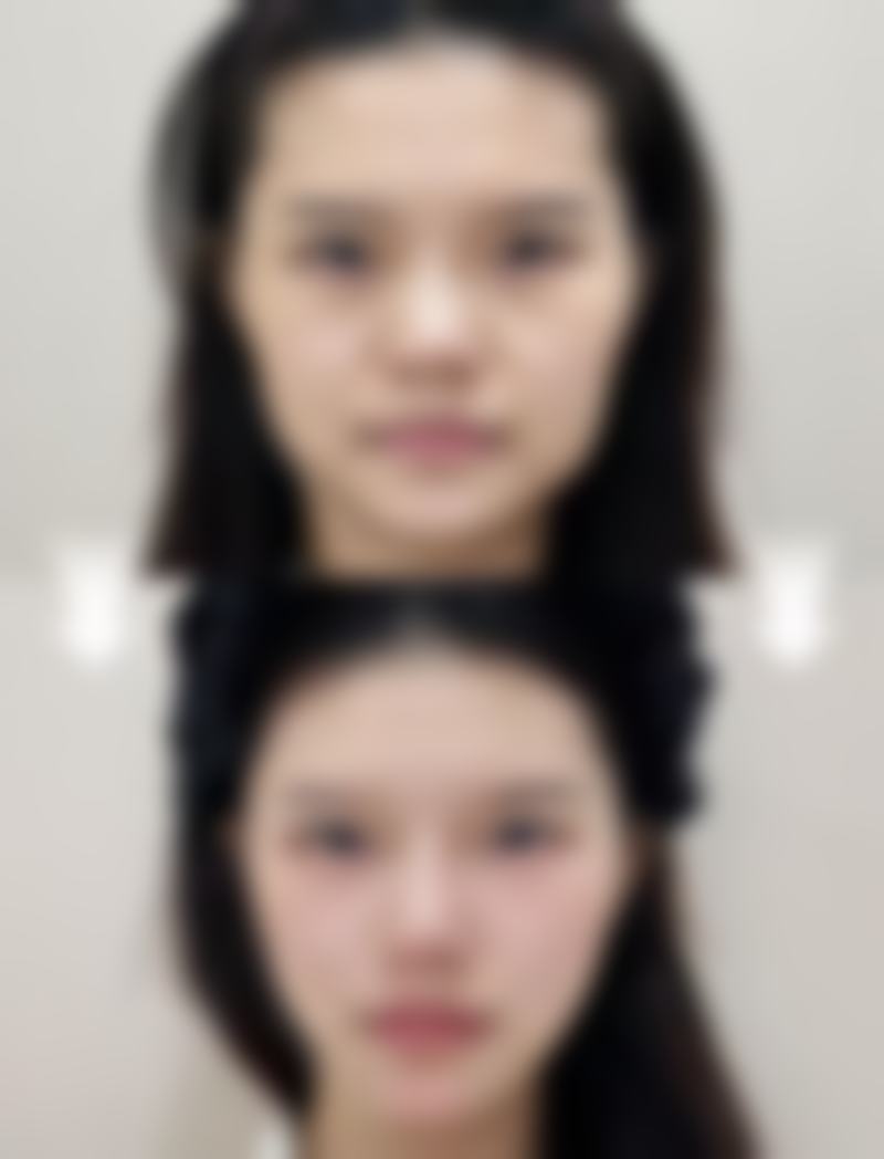 赵芙郡医生做手术价格
