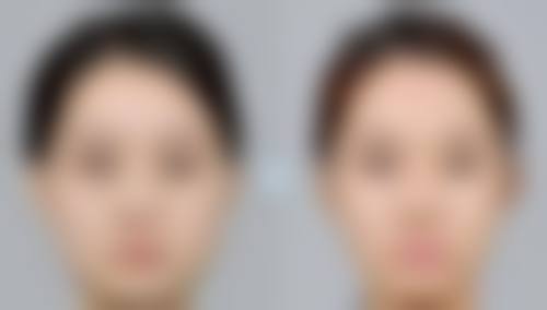 曹金喜医生顾客实例图片
