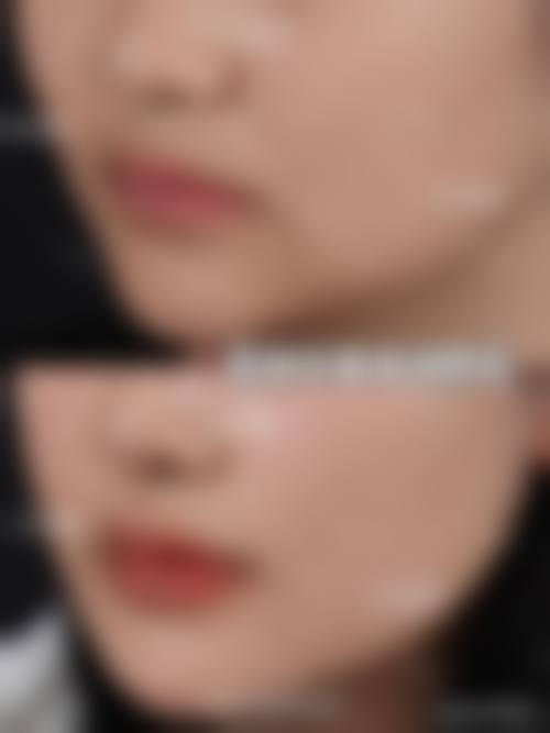 长春刘金梅美容整形外科诊所更擅长什么手术