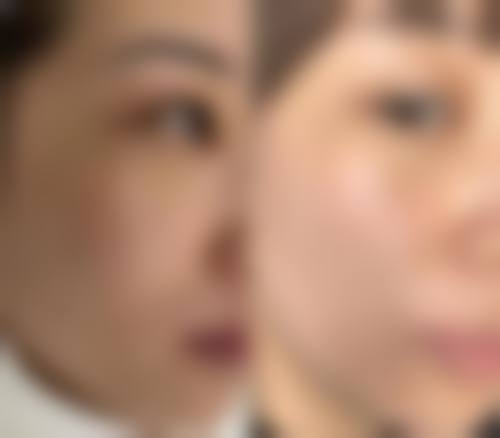 成都中德圣华医疗美容诊所更擅长什么手术