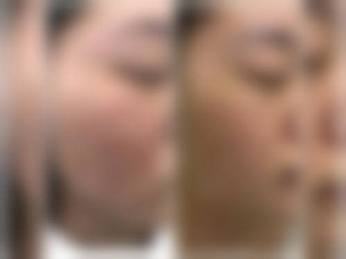 青岛市黄岛区中医医院整形美容科项目特色
