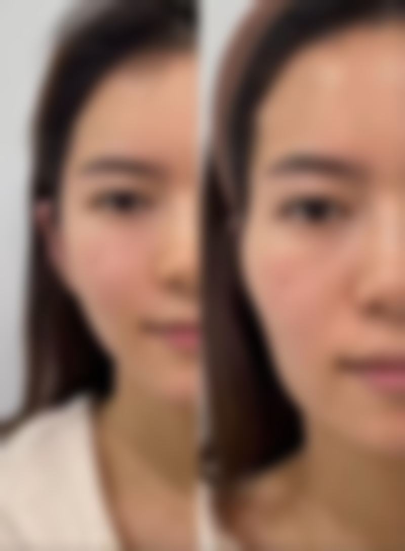 深圳美瑞尔医疗美容门诊部价格表