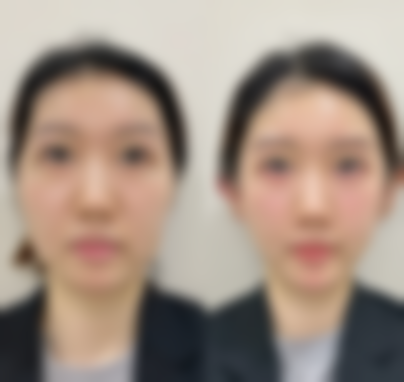 催佑熙医生项目优势