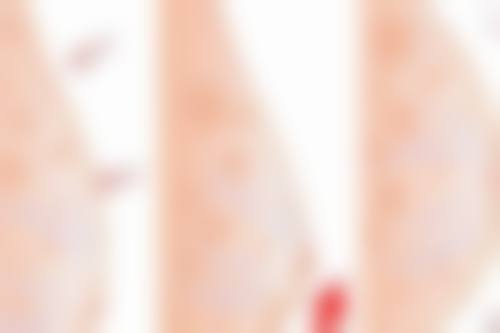 刘亚军 医生口碑如何