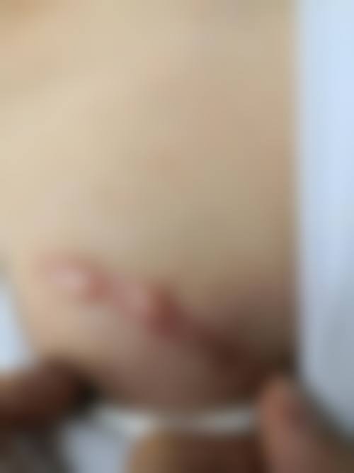 刘亚军 医生做手术价格