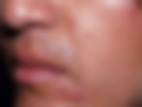 宜春伊美美容整形外科诊所更擅长什么