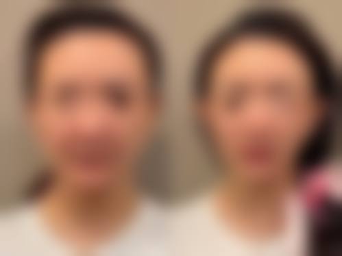 福州曙光(国内外)整形美容医院口碑评价如何