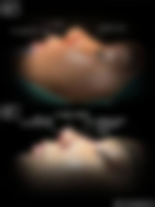 崔子伟医生顾客实例图片