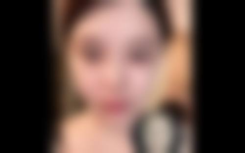 整形后的护理与注意事项
