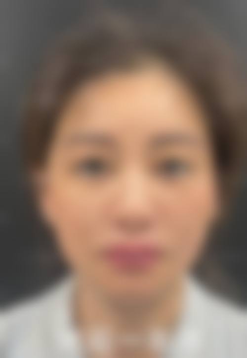 崔子伟医生项目优势