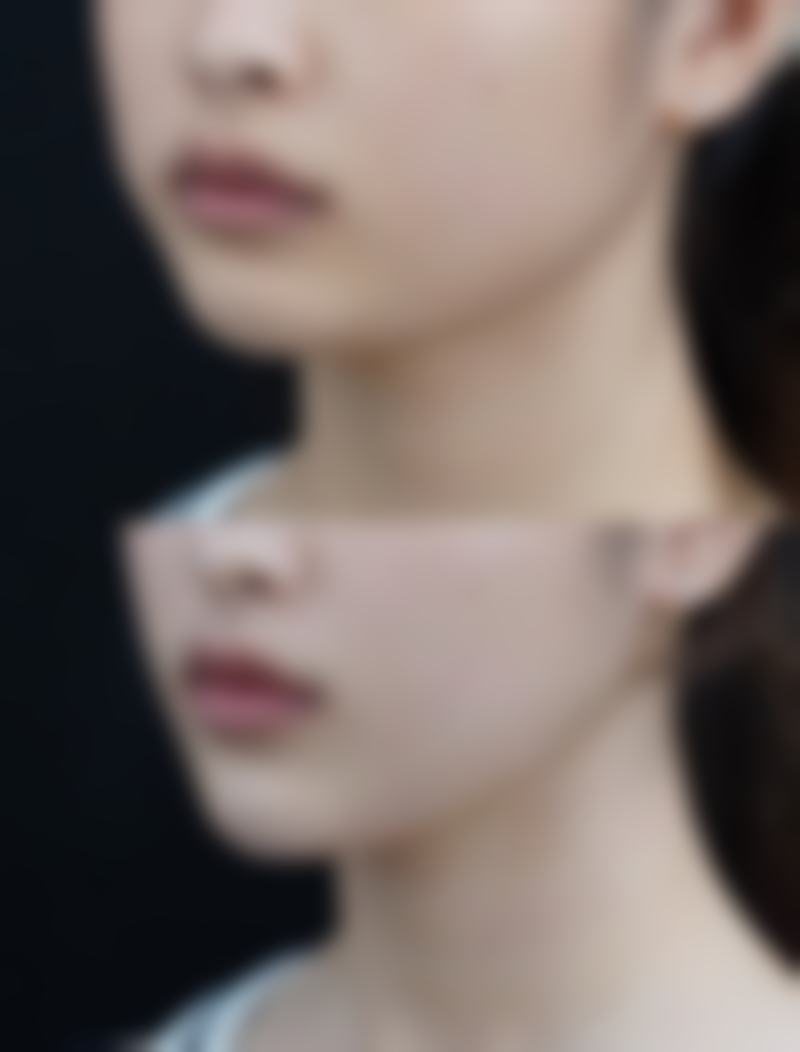 南昌优壹美（原千伊美）医疗美容门诊部价格表