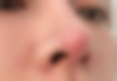 孙奎医生简介做手术价格