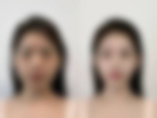 湖州南浔新一美医疗美容门诊部价格表