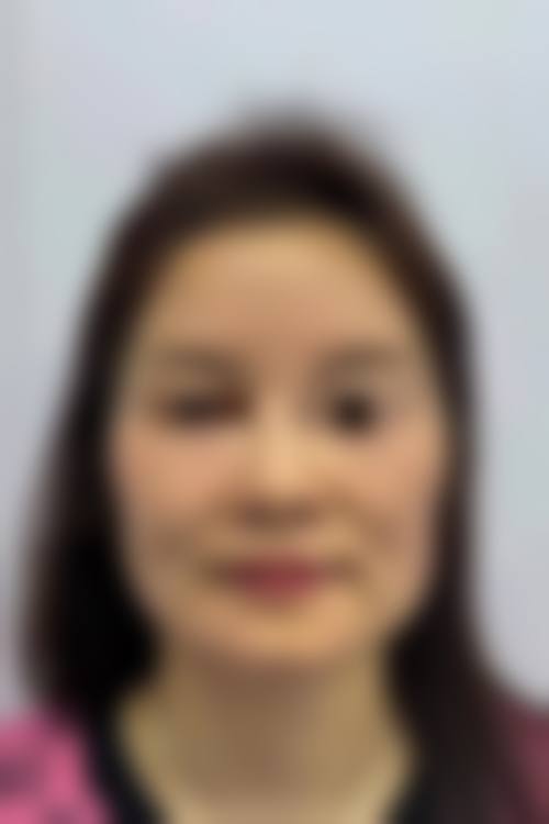 杨成医生简介做手术价格