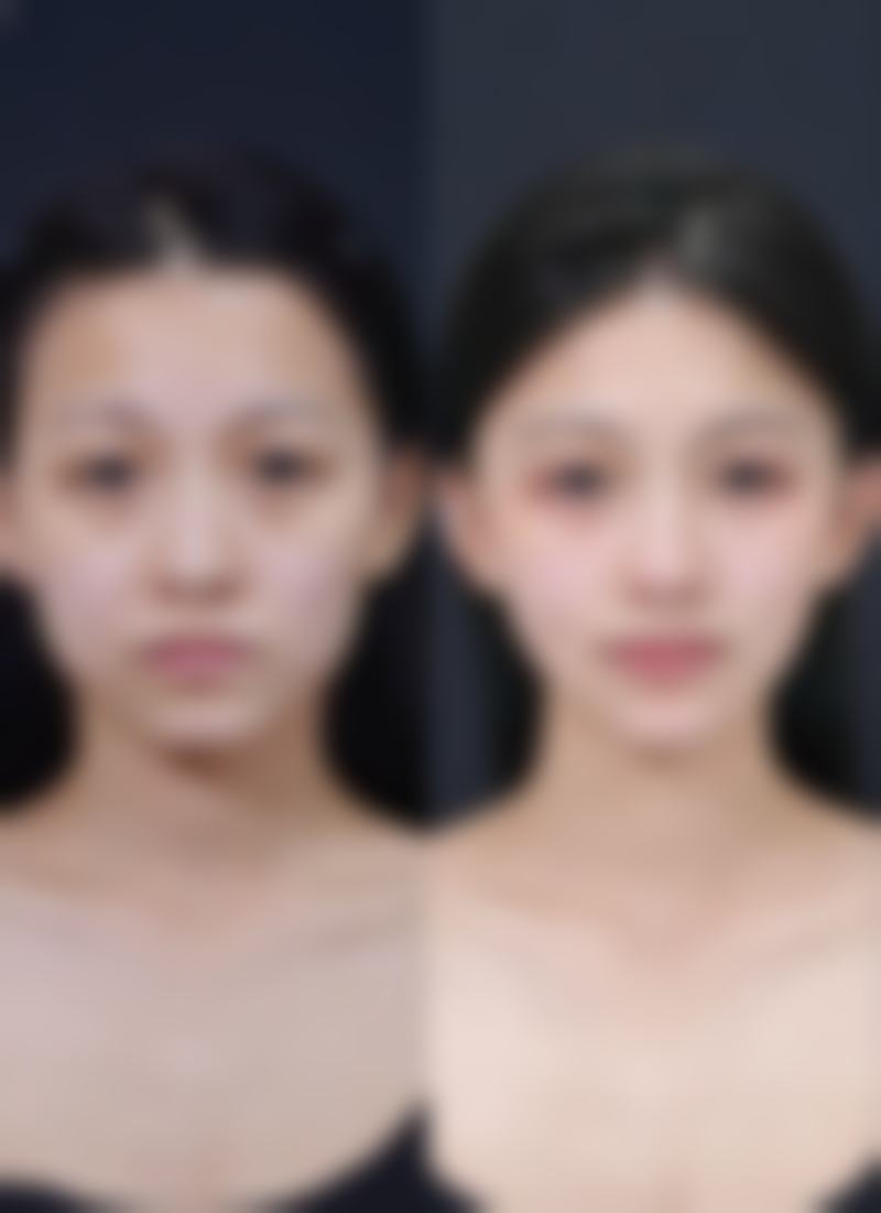 韩国江南NANOORI医院价格表