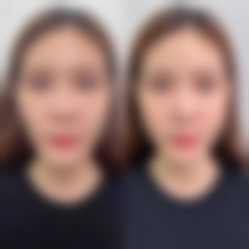 厦门崔美花尤加整形医院口碑好不好