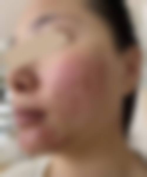 清远华美整形口碑情况