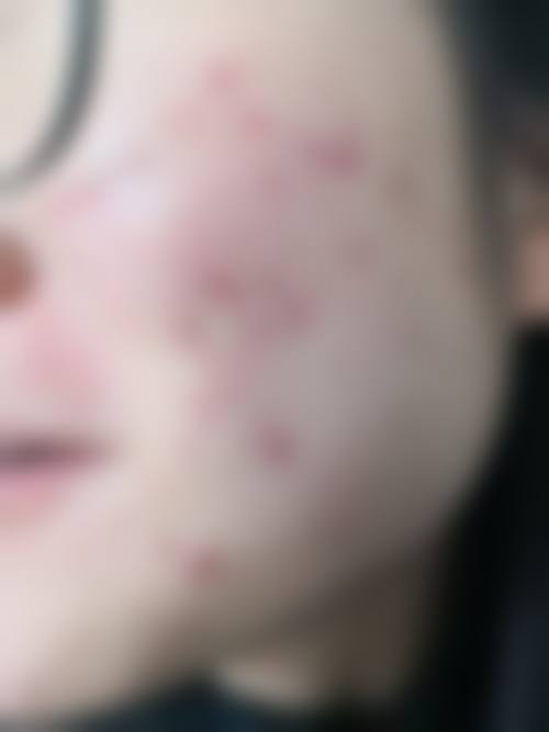 深圳贝漾美天整形门诊部价格表