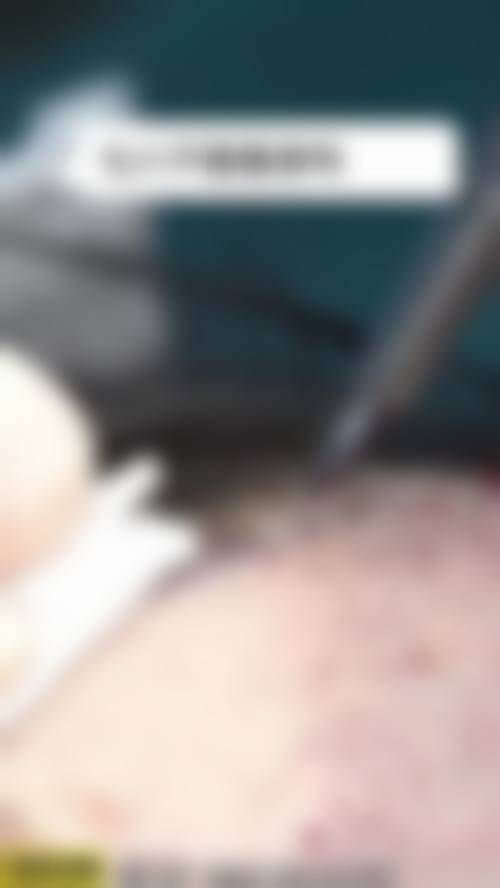 张佩莲医生简介做手术价格