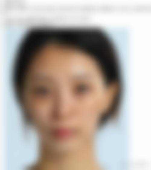 厦门医美整形失败维权实例汇总