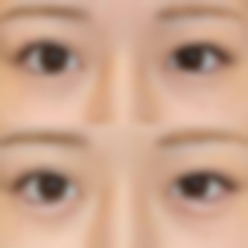 中山刘晴大漂亮整形医院口碑好不好?附真实患者口碑评价