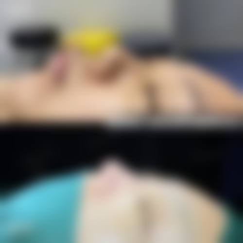 七、湘潭华美整形医院怎么样口碑好不好？附真实患者口碑评价