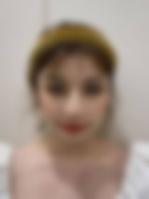 上海比华利医疗美容整形医院项目特色